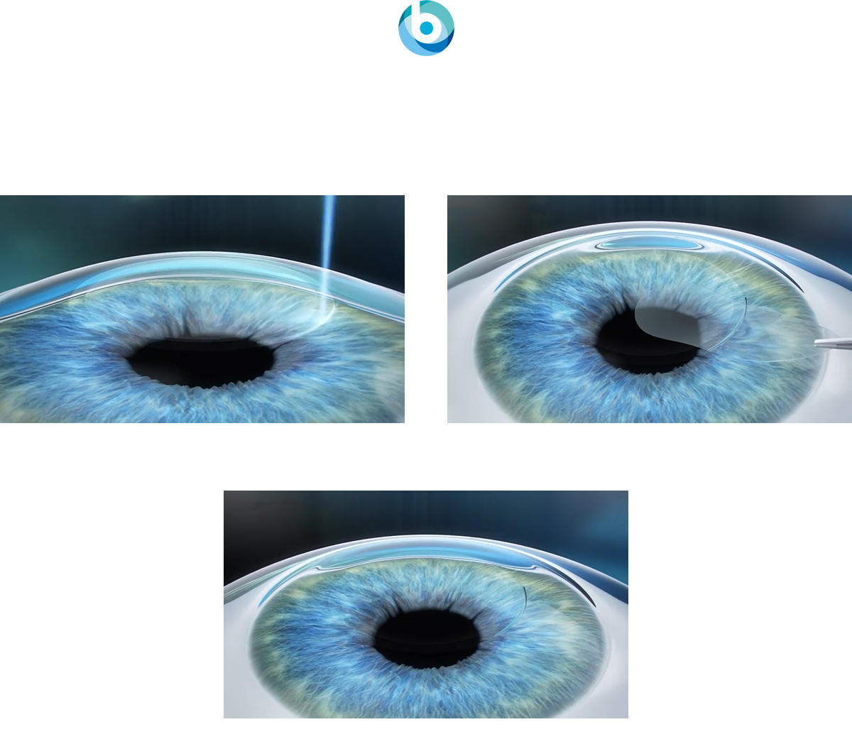 
- ȱ 似   
-  ǥ Ͽ   似  
-  ּ  ( 2mm) 
-   â  и   